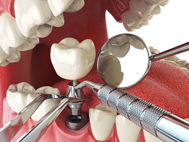 Best Emergency Dental Surgery in Wautoma, WI